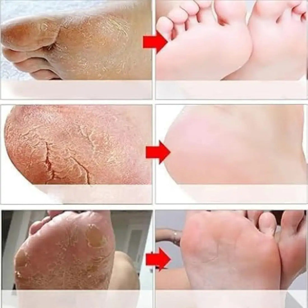 Goat Milk Exfoliating Foot Mask with Nicotinamide | Deep Moisturising & Dead Skin Removal Foot Mask